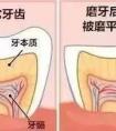 晚上睡覺為什么會磨牙？