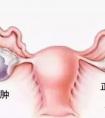 體內(nèi)多處長囊腫是什么原因