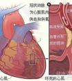 蘇貴元扮演者陳堅雄逝世，相關人員透露細節(jié)，什么會誘發(fā)心梗？