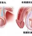 睪丸小怎么回事