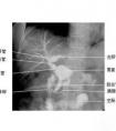 做完x光后多久可以懷孕