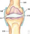 半月板損傷 滑膜炎是一回事嗎